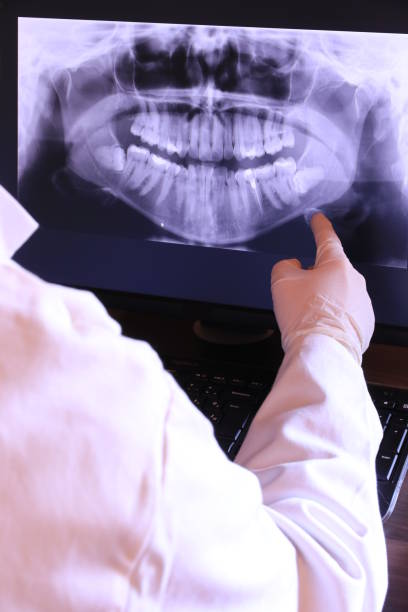 Best Emergency Root Canal Therapy in Watts Mills, SC